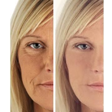 Axis-Dynamics | Age Perfect: Night Repair Cream + Vitamin C+ Serum