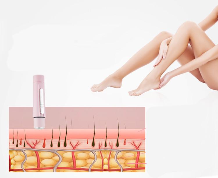 Illustration of a hair removal device with a close-up of skin layers and a person's legs. able components on a white background. Best onine retail store. Axis-Dynamics