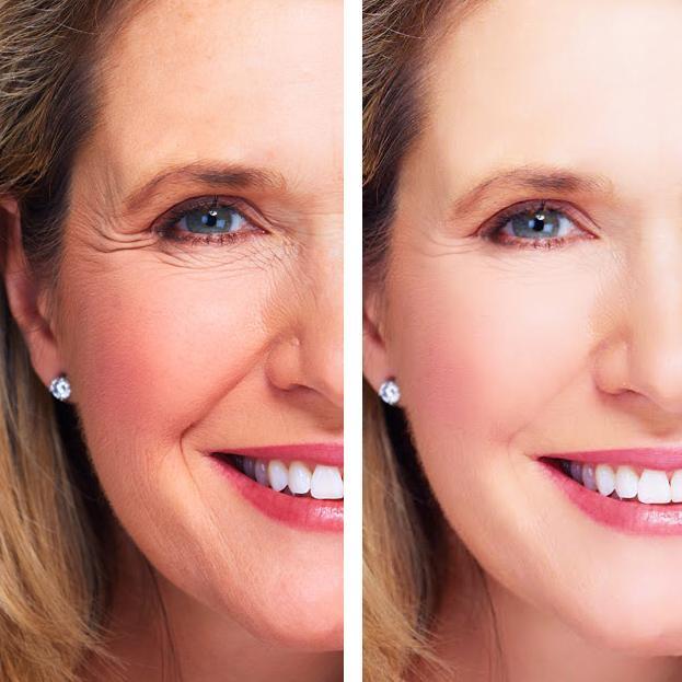 Side-by-side comparison of a woman's face with and without cosmetic treatment. Best online retail store. Axis-Dynamics