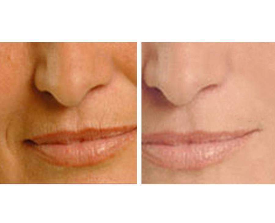 Axis-Dynamics | Age Perfect: Night Repair Cream + Vitamin C+ Serum